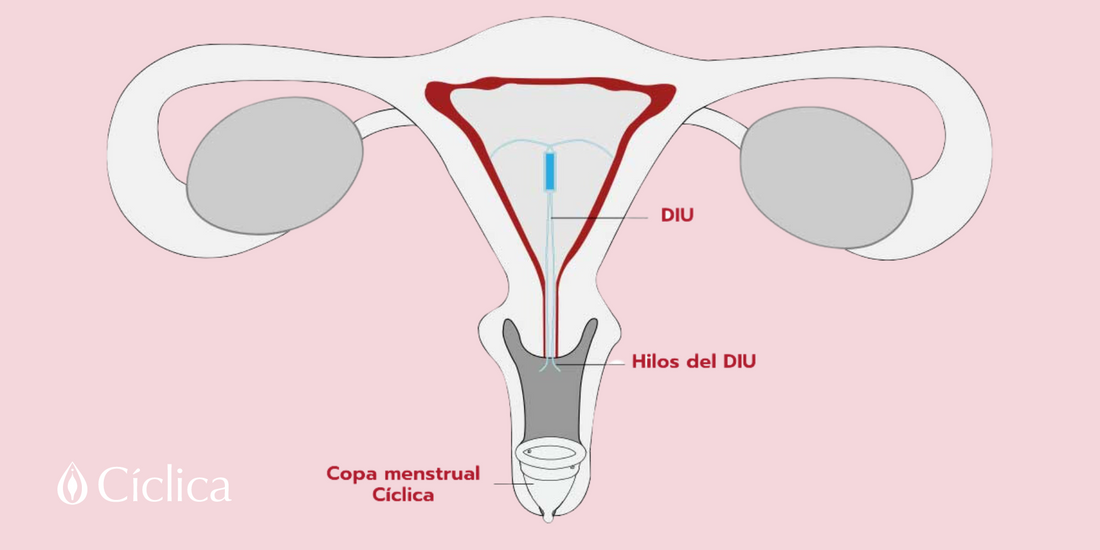 ¿Puedo usar la copa menstrual si tengo un DIU?